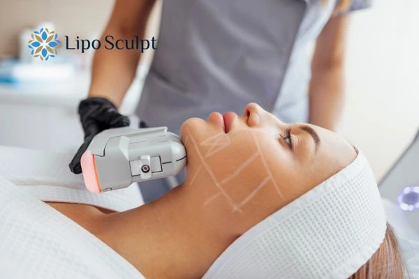 HIFU vs Botulinum Toxin: Understanding the Differences 1 HIFU vs Botox Bushey What is the best option for you?