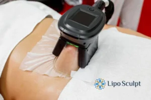 Cryolipolysis Helping You Getting that Perfect Summer Body 3 Cryolipolysis Bushey can give you the best summer body - contact us today!
