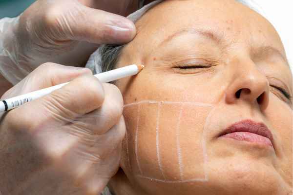 CryoPen: 5 Skin Concerns It May Be Used to Treat 4 What should you ask before having CryoPen treatment Bushey?