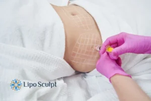 Are The Results From Aqualyx Permanent? 1 Do you want to know how long Aqualyx Bushey results last?