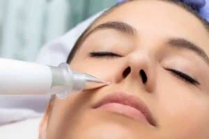 Best Actinic Keratoses Removal 3 Actinic keratoses Bushey solutions - book in today!