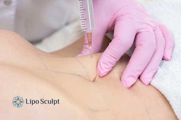 Aqualyx for Muffin Tops: What to Know Before Fat-Dissolving Injections 4 Are there risks Bushey?