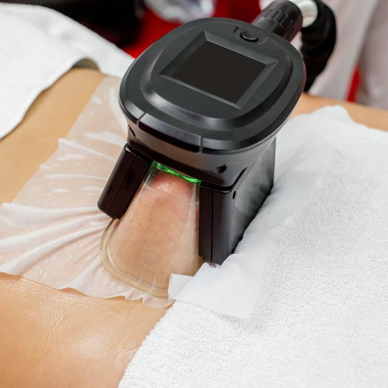 Fat Freezing treatment Bushey